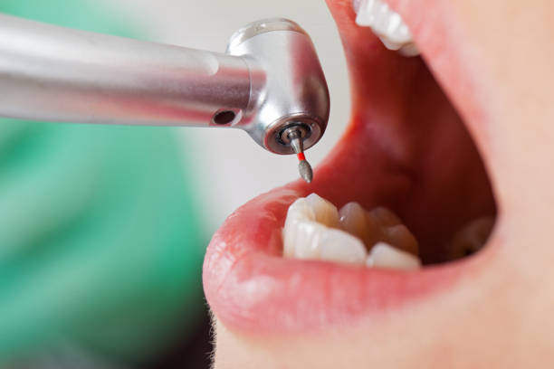 Best Emergency Dental Care for Broken or Chipped Teeth in Pinson, AL